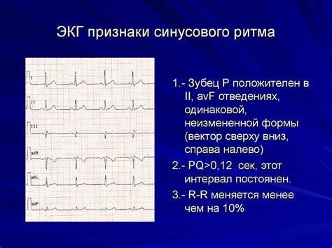 Как измерить синусовый ритм при разных положениях ЭОС