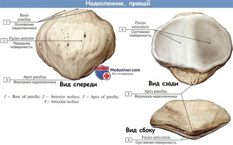 Как определить надколенник тип 2?