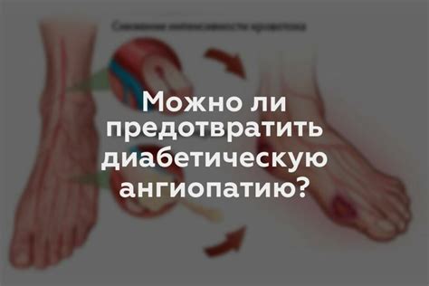 Как предотвратить диабетическую невропатию и потерю чувствительности в ногах