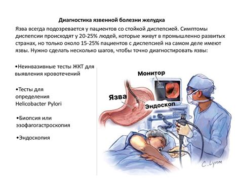 Как проводится обследование желудка и двенадцатиперстной кишки с помощью ЭГДС