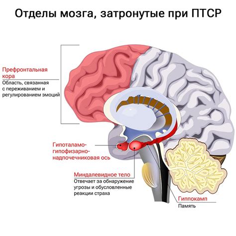 Как проявляется ПТСР