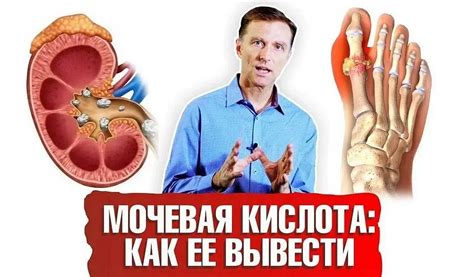 Как снизить уровень мочевой кислоты в крови?