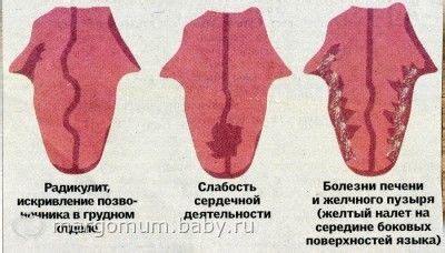 Как справиться с проблемой красного и щиплетящего кончика языка