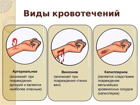 Как эффективно остановить кровотечение при глубокой ране на руке?