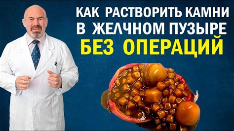 Каши и хлебные изделия для желчекаменной болезни