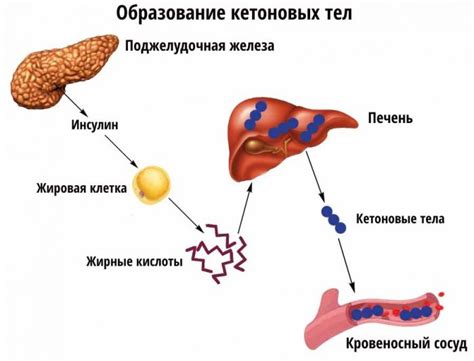 Кетоновые тела: определение и значение в моче