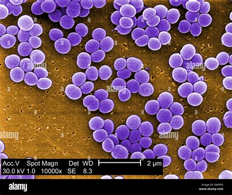 Клиническое значение концентрации Staphylococcus aureus 10^4