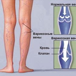 Когда нужно обращаться за медицинской помощью, если чешется запястье правой руки