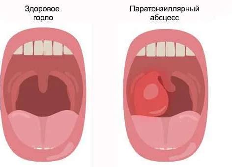 Когда следует обратиться за медицинской помощью, если вам становится плохо после выпитой воды?