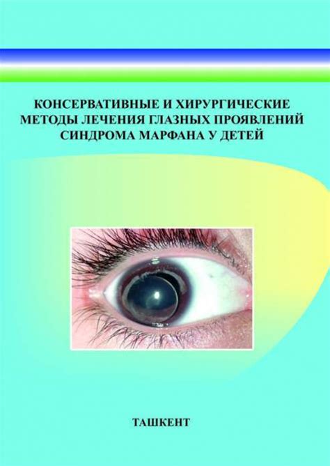 Консервативные методы лечения камня размером 5 мл