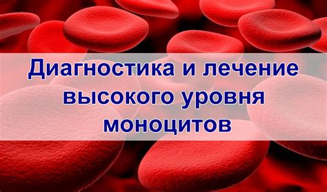 Лечение и профилактика повышенного уровня моноцитов