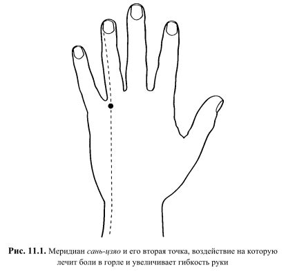 Лечение и профилактика согнутого безымянного пальца