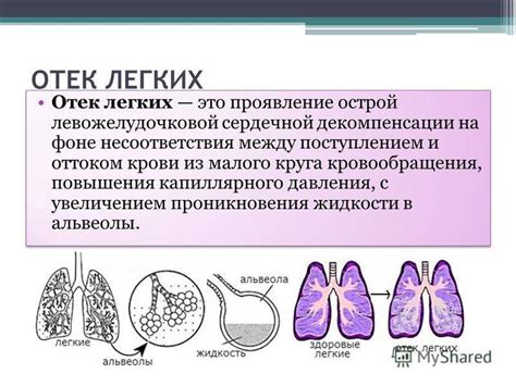 Лечение отека легких у кошки