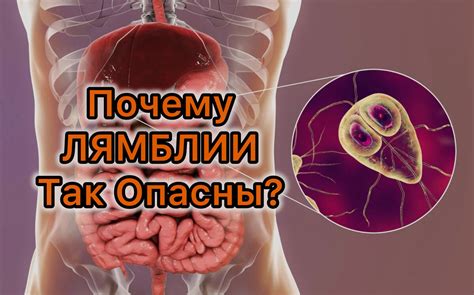 Лямблии: что это такое?