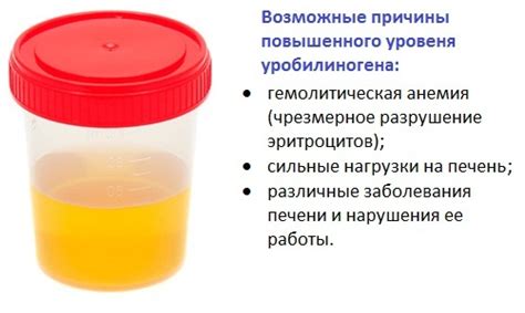 Методы диагностики и лечение повышенного уровня уробилиногена в моче