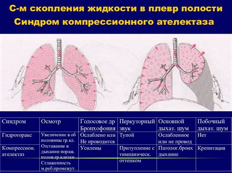 Методы диагностики скопления жидкости под коленкой