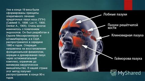 Методы лечения гнойных процессов в пазухах носа