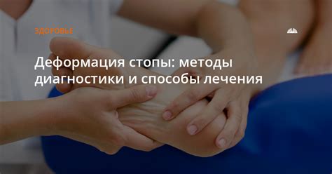 Методы лечения ушиба стопы