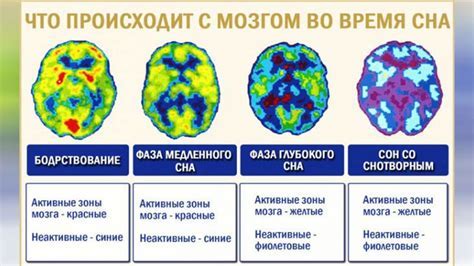 Механизмы возникновения случаев троганья во время сна