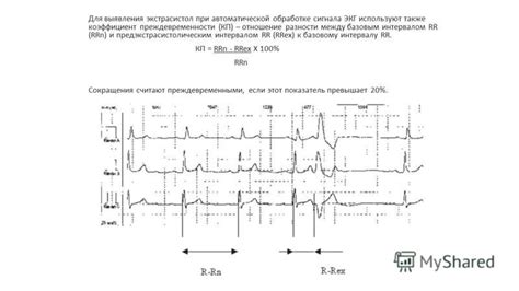 Механизмы гиперадаптации QT к RR интервалу