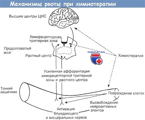 Механизм образования черной рвоты