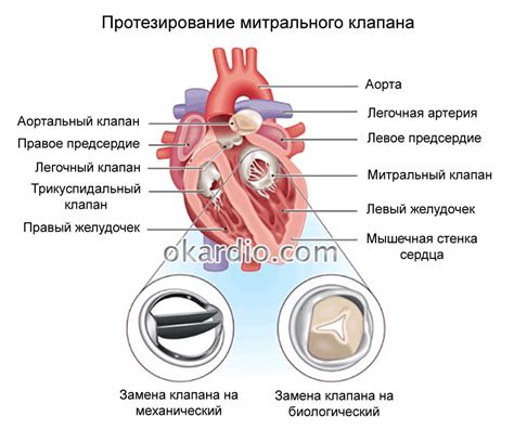 Митральная клапанная регургитация 1 степени