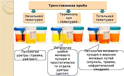 Мозаика общих признаков возникновения следов крови в моче