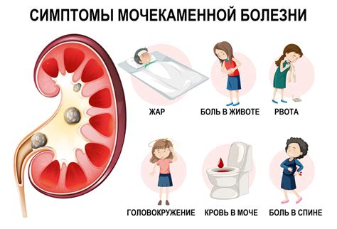 Моча золотистого цвета: значение и причины у мужчин