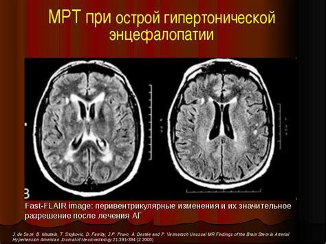 Назначение Аксамона в неврологии