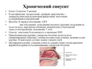 Народные методы очистки носовых пазух