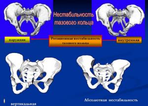 Неадекватная фиксация повреждений