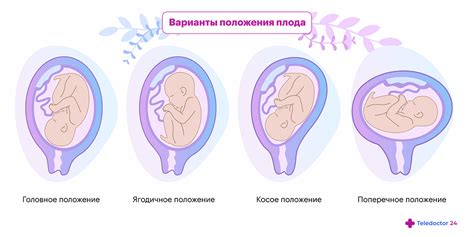 Неправильное расположение белья