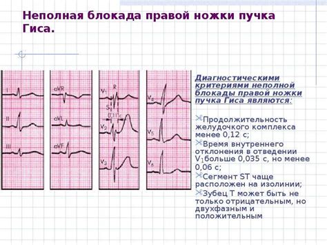 Нетренированность мышц правой ножки