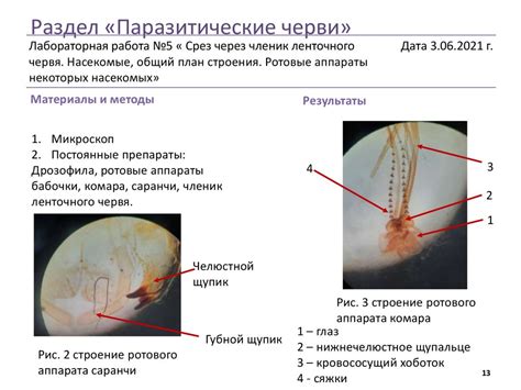 Обнаружение эпителия уретрального u: методы и технологии