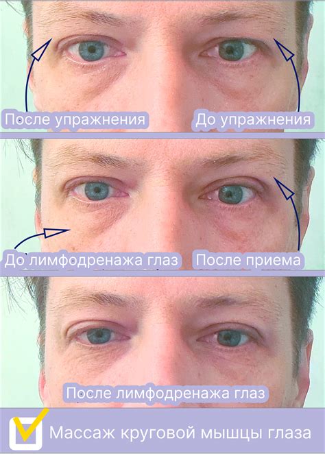 Об учащенных причинах закрытия век и отека глаз