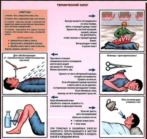 Оказание первой помощи при ожоге руки