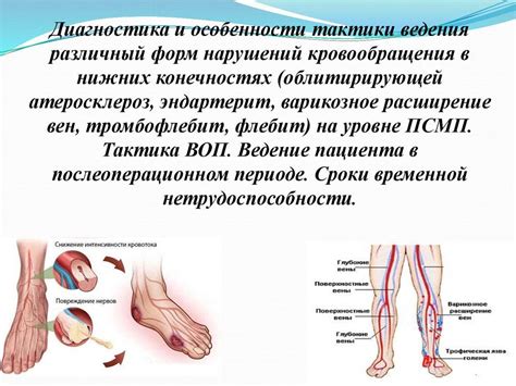 Онемение вызванное нарушением кровообращения