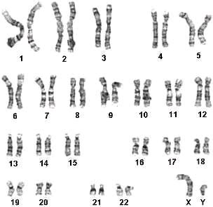 Определение кариотипа 46 XY