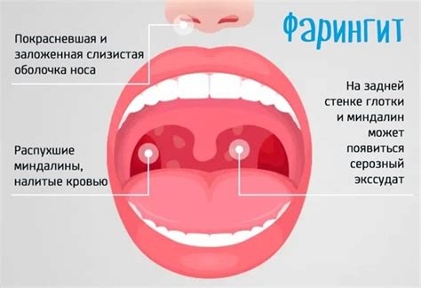 Определенные заболевания, вызывающие белые комочки