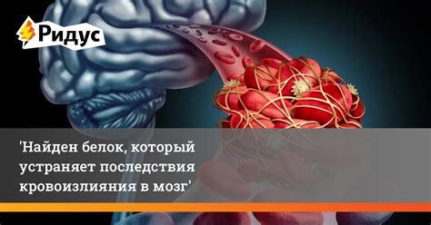 Осложнения и последствия кровоизлияния в мозг