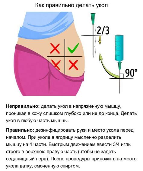 Осложнения при ошибочной инъекции препарата в ягодицу