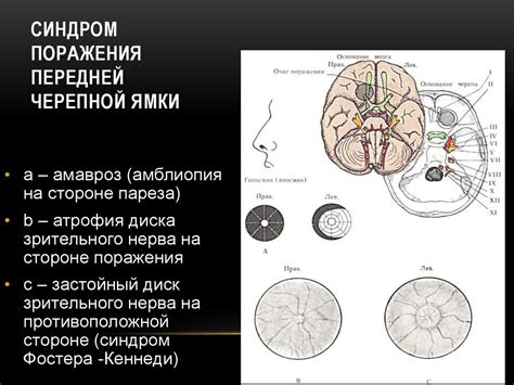 Осмотр и диагностика поврежденной коры