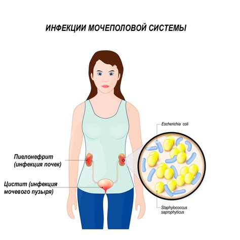 Основные группы болезней, сопровождающихся осадком в моче