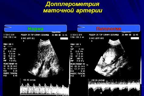 Основные показатели допплерографии