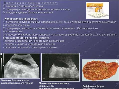 Основные принципы питания при наличии желчного камня