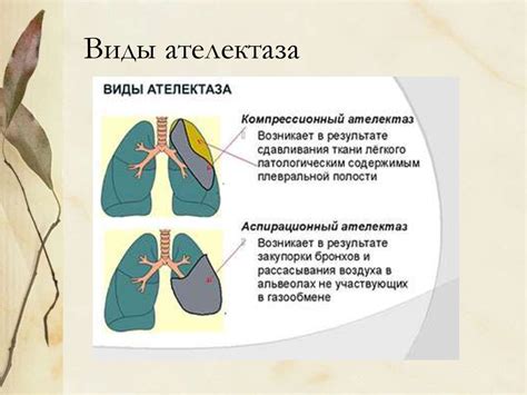 Основные причины ателектаза легкого у взрослых