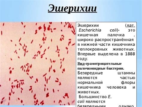 Основные причины инфекции Escherichia coli у женщин