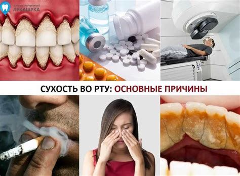 Основные причины сухости в горле и носоглотке