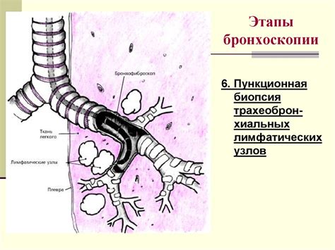 Основные этапы и методы бронхоскопии