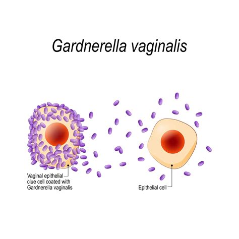 Особенности Gardnerella vaginalis